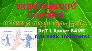 വേരിക്കോസ് വെയിൻ ലക്ഷണങ്ങളും ചികിൽസ രീതികളും  Ayurvedic Treatment for Varicose Veins Dr T L Xavier [upl. by Dranyar653]