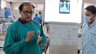 Bloodless  Painless  Ultrasound guided Thoracentesis  Dr Gyanendra Gupta [upl. by Ayenat]