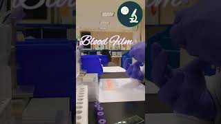 Peripheral Blood Smear [upl. by Squier723]