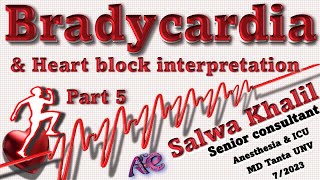 ECG 5 Bradycardia amp Heart block interpretations [upl. by Jacquelynn]