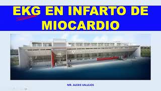 ELECTROCARDIOGRAMA EN INFARTO DE MIOCARDIO I [upl. by Andromada]