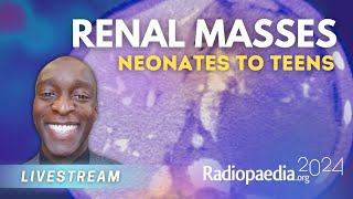 Renal masses neonates to teens with John Adu [upl. by Dnomad]