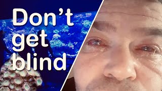 Dont Get Blind Because of a Reef Aquarium [upl. by Odie]