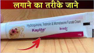 Kaylite Cream Uses Side Effects Price and Review Hindi [upl. by Montagna]