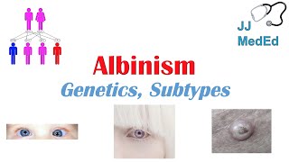 Albinism  Genetics Different Types and What You Need to Know [upl. by Hillier]