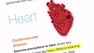 Diabetes and Exercise What precautions to take while exercising if I have diabetes amp heart problem [upl. by Zednanref501]