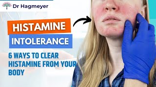 How to Clear Histamine How To Get Rid of Histamine in 6 Easy Steps💪 Dr Richard Hagmeyer [upl. by Aneeg]