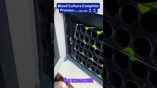 🩸Blood 💉culture at Lab technician👨‍🔬 trendingshorts viralshort youtubeshort [upl. by Nomannic]