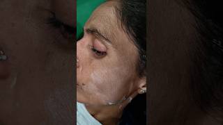 Rica Brazilian wax wedding vairalvideo [upl. by Clement]