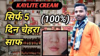 Kaylite cream केलाइट क्रीम साइड इफेक्ट्स यूज केसे करें [upl. by Ael806]