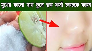 ২ মিনিটে মুখের কালো দাগ দূর করার উপায়লেবু চিনির সাথে মাত্র ১টি উপকরণ মিশিয়ে ত্বক ধবধবে ফর্সা করুন [upl. by Primo918]