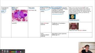 Acute Leukemia Mnemonics [upl. by Amikay]