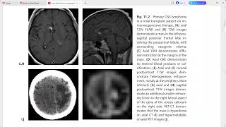 CASE BASED BRAIN IMAGING [upl. by Delwin]