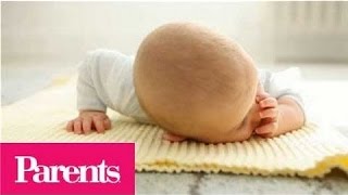 Cradle Cap  When to Worry  Parents [upl. by Eolhc510]