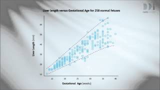 Trend scatter and outliers [upl. by Graniah431]