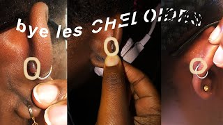 ✏︎ Comment en finir avec les chéloïdes  Gennys [upl. by Gonnella229]