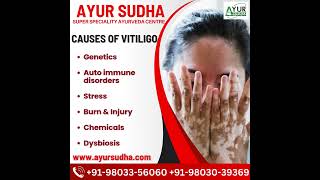 Causes amp Symptoms of Vitiligo [upl. by Sandro]