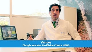 Varices  Cirugía Vascular Periférica  Clínica MEDS [upl. by Keelin]