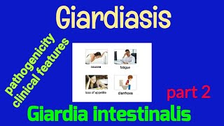 Pathogenicity Of Giardiasis  Clinical Features of Giardiasis  Giardiasis  AM Biologie Notes [upl. by Hailee]