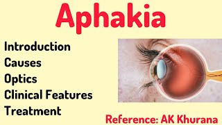 Aphakia AK khurana 6th edition Optocruisers optometry optometrists aphakia eye youtube [upl. by Berkow163]