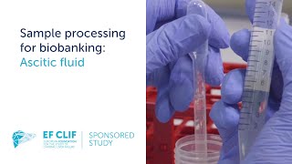 Sample processing for biobanking Ascitic fluid [upl. by Urquhart]