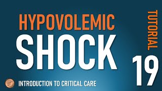 Hypovolemic Shock [upl. by Nobe]