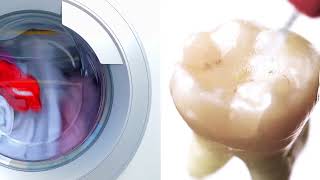 SmartLite Pro EndoActivator™ Washing Machine Comparison [upl. by Asira]