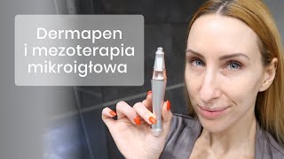 MEZOTERAPIA MIKROIGŁOWA W TWOIM DOMU [upl. by Ruhl895]