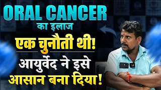 अब आयुर्वेद ही मेरे लिए एकमात्र आशा है Oral Cancer Mouth Cancer  Mouth Cancer Symptoms in Hindi [upl. by Una]