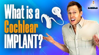 What is a Cochlear Implant [upl. by Aihsatsan387]