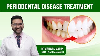 Periodontal Disease Treatment  GUM Disease  What is the Best Treatment for Periodontal Disease [upl. by Enirol180]