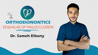 Sequalae of malocclusion  orthodontics [upl. by Bebe]