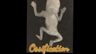 Ossification  Meaning  Pronunciation  Usage [upl. by Dahsraf]