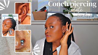 conch piercing 1month update keloids uncomfortable nights piercing pains cleaning etc [upl. by Zacharie]