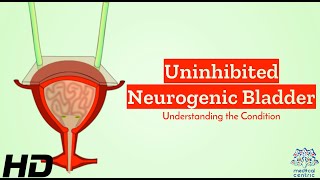 Uninhibited Neurogenic Bladder Demystified A Closer Look at the Condition [upl. by Ethyl]