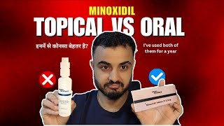 Topical Vs Oral Minoxidil  Which one is Best I used both of them amp heres my results [upl. by Harat]