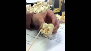 Ethmoid sinus bone model in anatomy [upl. by Anavahs979]