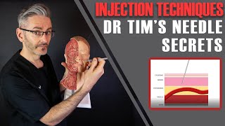 Injection Techniques Best Angles Depths How To Aspirate amp Stabilise Aesthetics Mastery Show [upl. by Kalman]