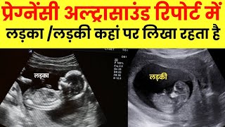 Pregnancy ultrasound se kaise pata krein ki ladka hai ya ladki [upl. by Aveer]