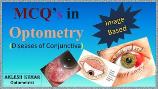 MCQS IN OPTOMETRY  DISEASES OF CONJUNCTIVA  Part 20 [upl. by Chaker]