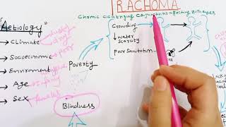 Trachoma  Pathogenesis Of Trachoma  conjunctivitis  ophthalmology  PART 01 [upl. by Dieball]