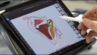 MYOLOGIE DE LEPAULE COIFFE DES ROTATEURS [upl. by Norad]