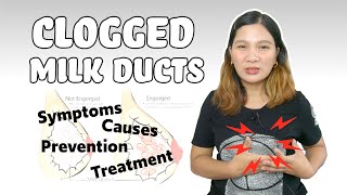 How to Treat Plugged or Clogged Milk Ducts  Causes Symptoms and Prevention  House Caraan [upl. by Behl]