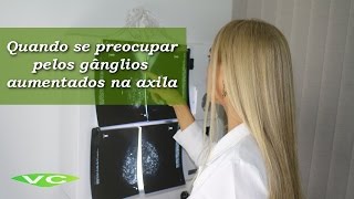 Gânglios na Axila ⚠️ ALERTA ⚠️ Quando deve se PREOCUPAR  Dra Vanderlea Coelho ®️ Câncer de Mama [upl. by Odnomor]