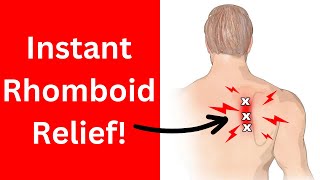 Fix Rhomboid Pain  With 2 Exercises [upl. by Enymsaj]