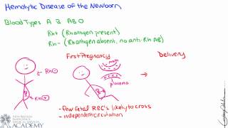 Clinical Correlation Hemolytic Disease of the Newborn [upl. by Conlee]