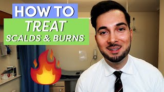 Burns  How To Treat Burns  How To Treat A Burn [upl. by Ydnor]