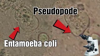 Entamoeba coli under the microscope pseudopods شاهد الأميبة تحت المجهر [upl. by Ttevi]