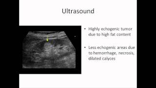 Angiomyolipoma of Kidney [upl. by Nerehs]