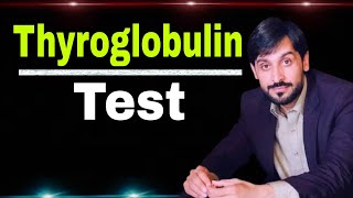 Thyroglobulin Test [upl. by Evvie]